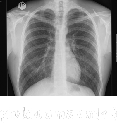 Pokaż kotku co masz w środku
