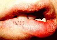 Sic